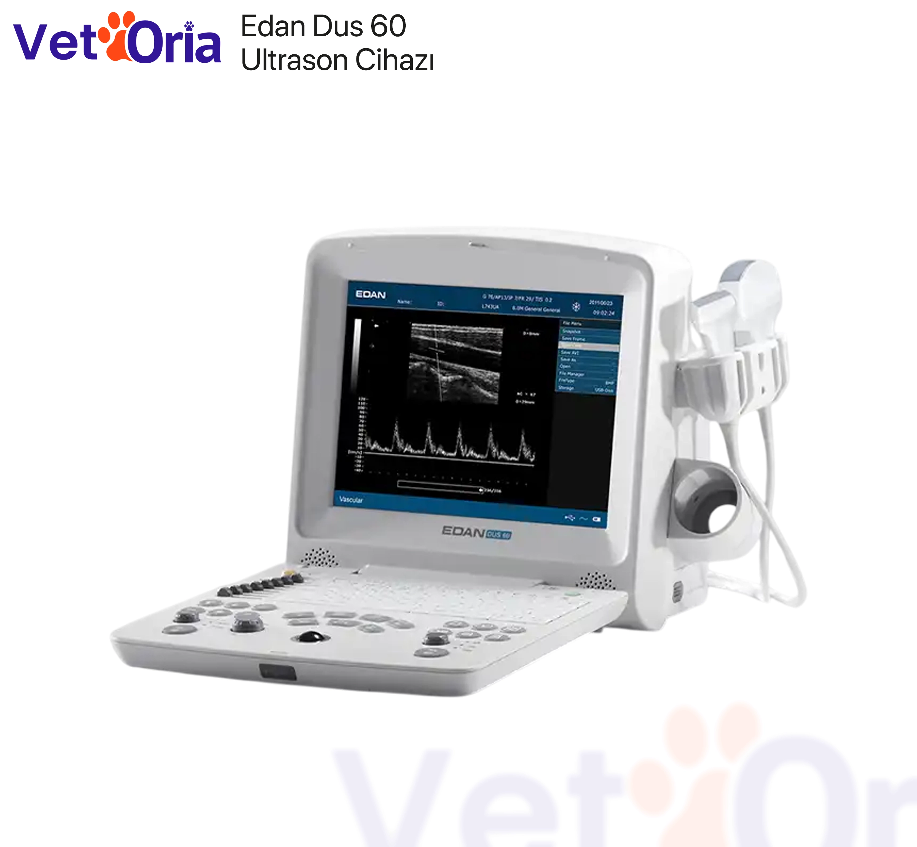                       Edan Dus 60 Ultrason Cihazı